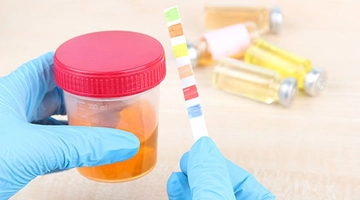 İdrar Rengi Özellikleri ve Faydaları Nelerdir?